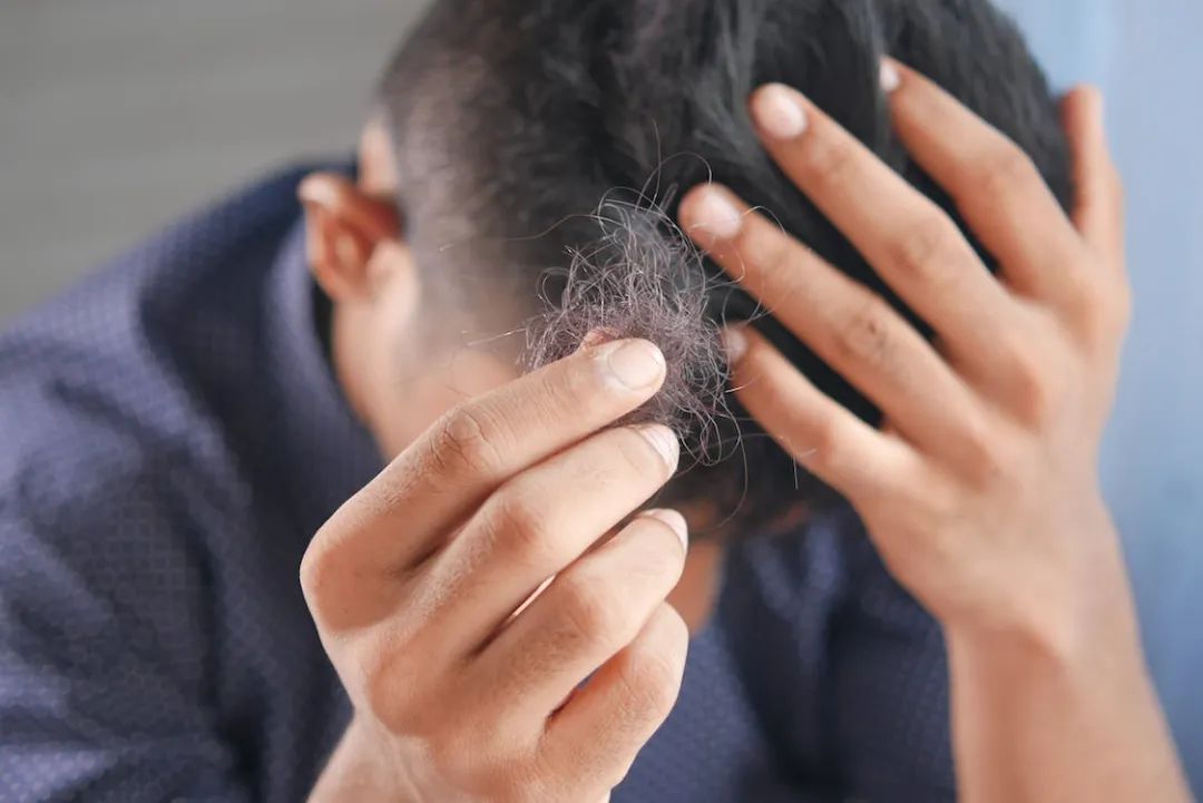 男子植个发，把命搭进去？为一头秀发，穷人只能去黑诊所赌命？